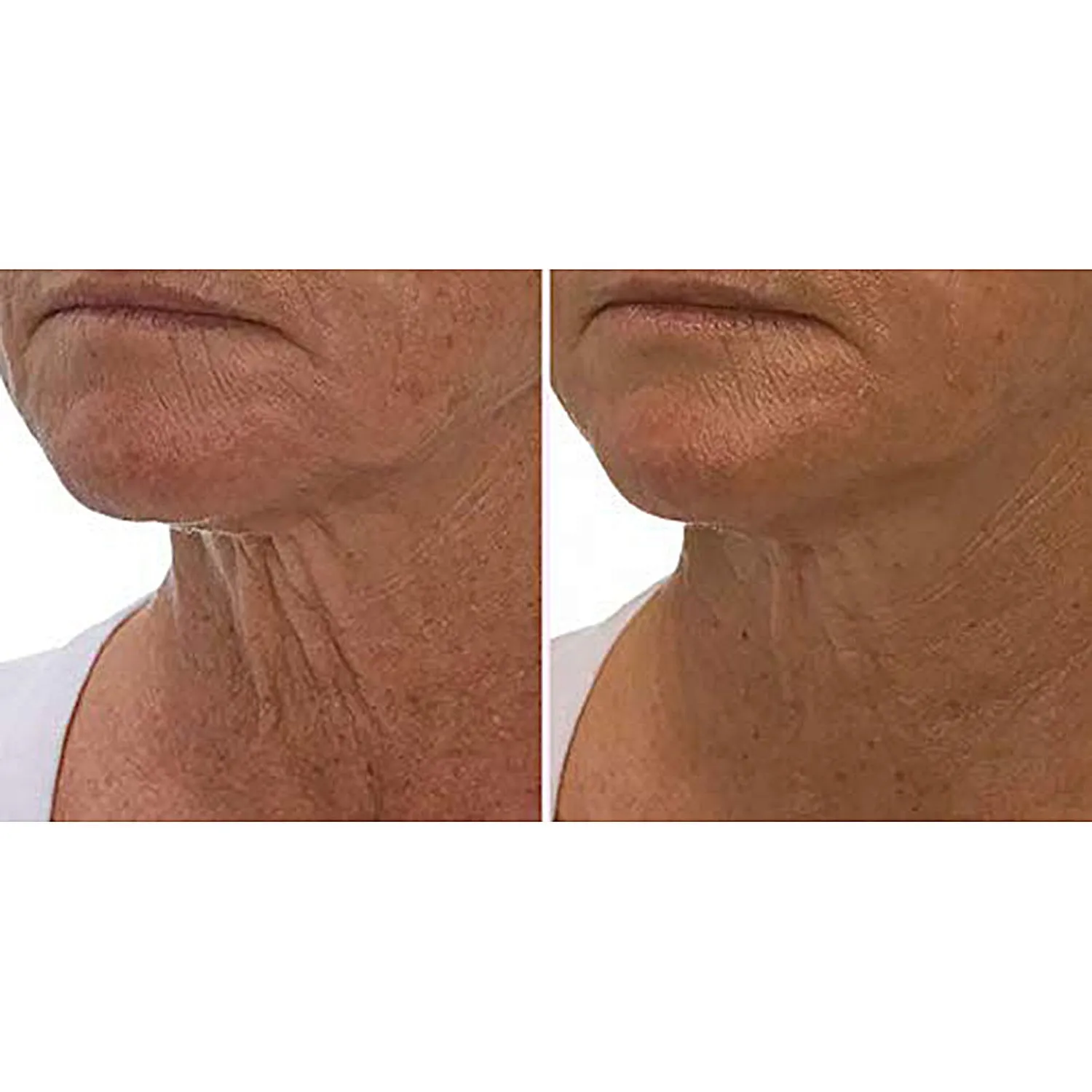 Evertone Crepe Gone Facial Souffle Anti Aging Skin Cream