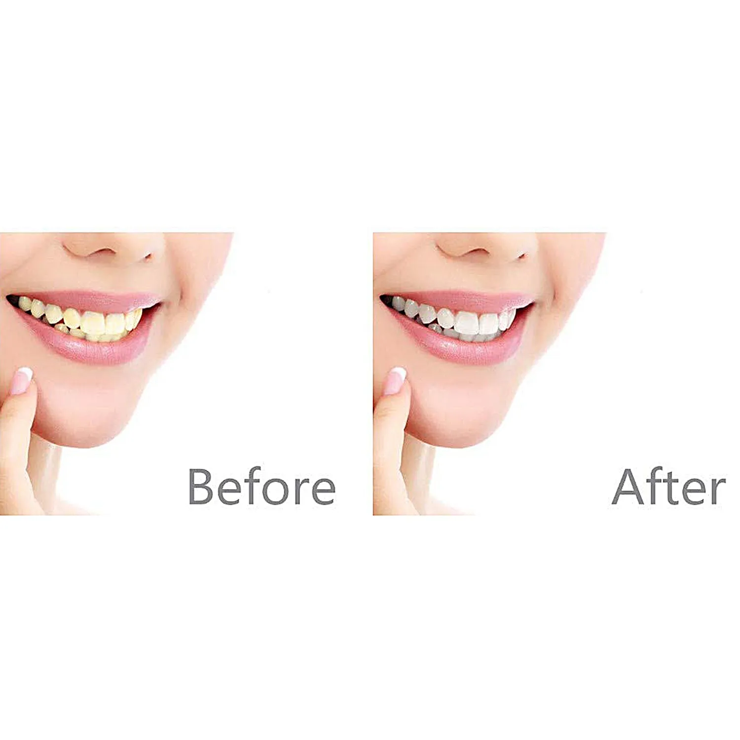 Evertone Fat Freezer™ Neck Firming Cream